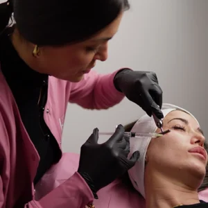 Mesoterapia periocular
