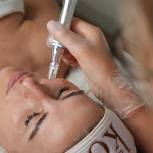 Microneedling periocular