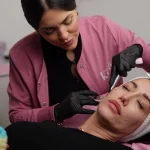 Reposición tercio medio: aplicación del tratamiento facial en Clínica KOA