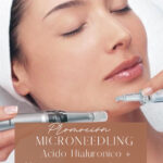 Promoción Septiembre - Microneedling