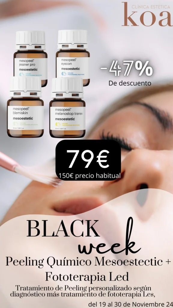 Promociones