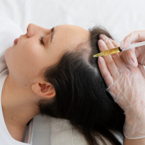Mesoterapia capilar