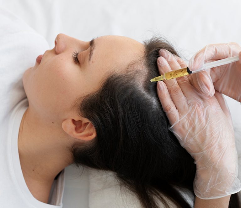 mesoterapia-capilar