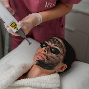 Hollywood peel