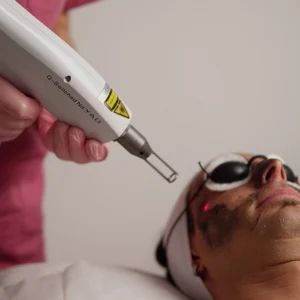 Hollywood peel Premium