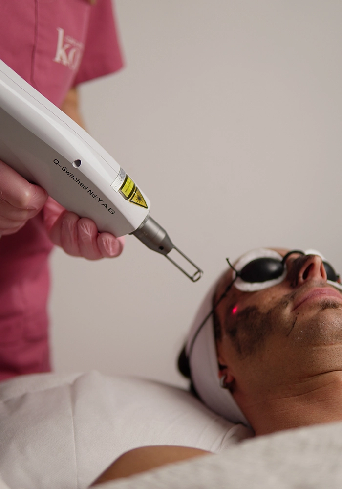 Hollywood peel premium con láser y máscara de carbón en Clínica KOA