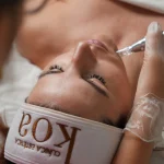 Microneedling personalizado