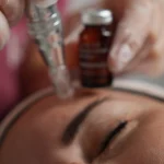 Peeling + Microneeling