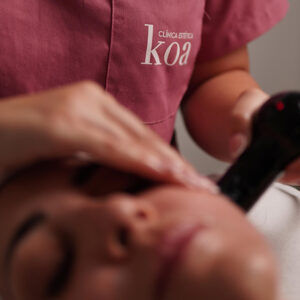 Radiofrecuencia Facial Deep 5 sesiones