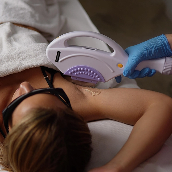 depilacion-shr-axilas