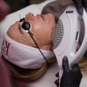 BONO DE 3 SESIONES Fotorejuvenecimiento Facial