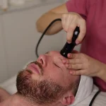 Radiofrecuencia Deep Facial aplicada en el rostro de un hombre en Clínica KOA