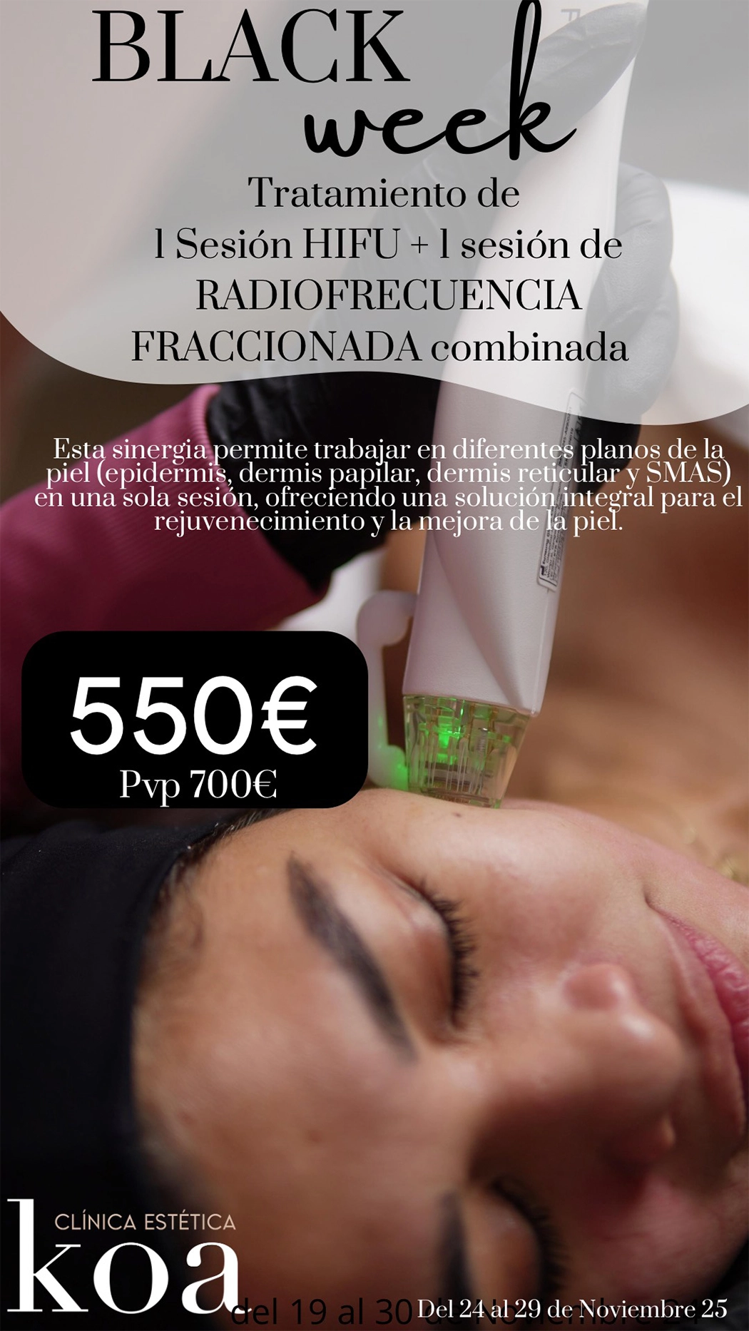 Promoción Black Week - Tratamiento de 1 sesión HIFU + 1 sesión de Radiofrecuencia Fraccionada Combinada