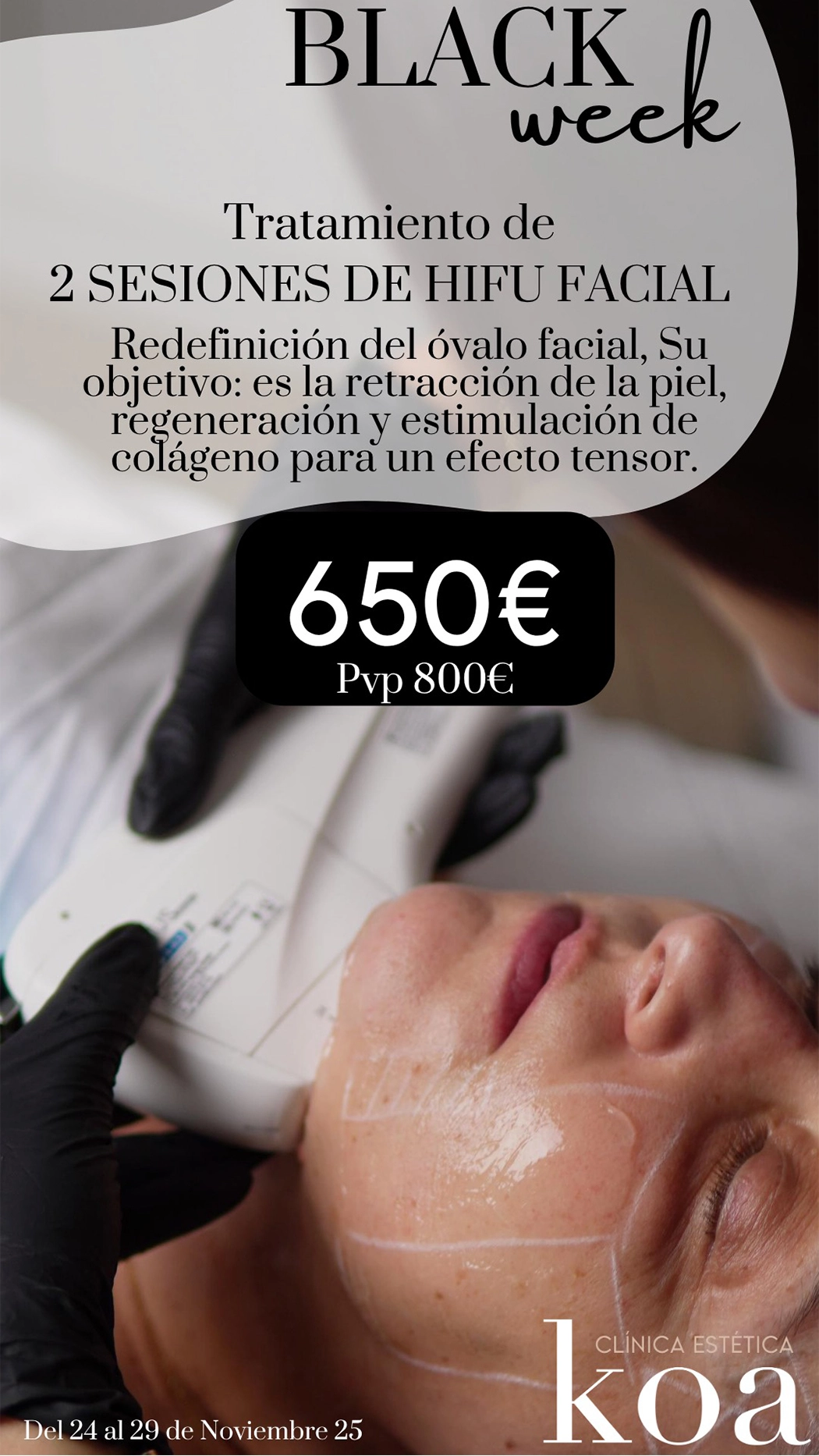 Promoción Black Week - Tratamiento 2 Sesiones de HIFU Facial