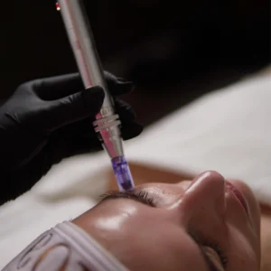 Tratamiento Maka 3 sesiones + microneedling periocular 3 sesiones