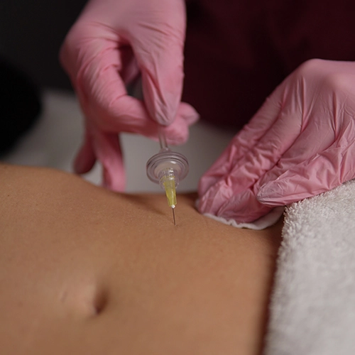 Carboxiterapia corporal profesional para celulitis y grasa localizada en Clínica Koa Valencia