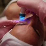 Higiene Skin Reset en Clínica Koa: higiene facial profesional con tecnología para limpiar y renovar la piel.