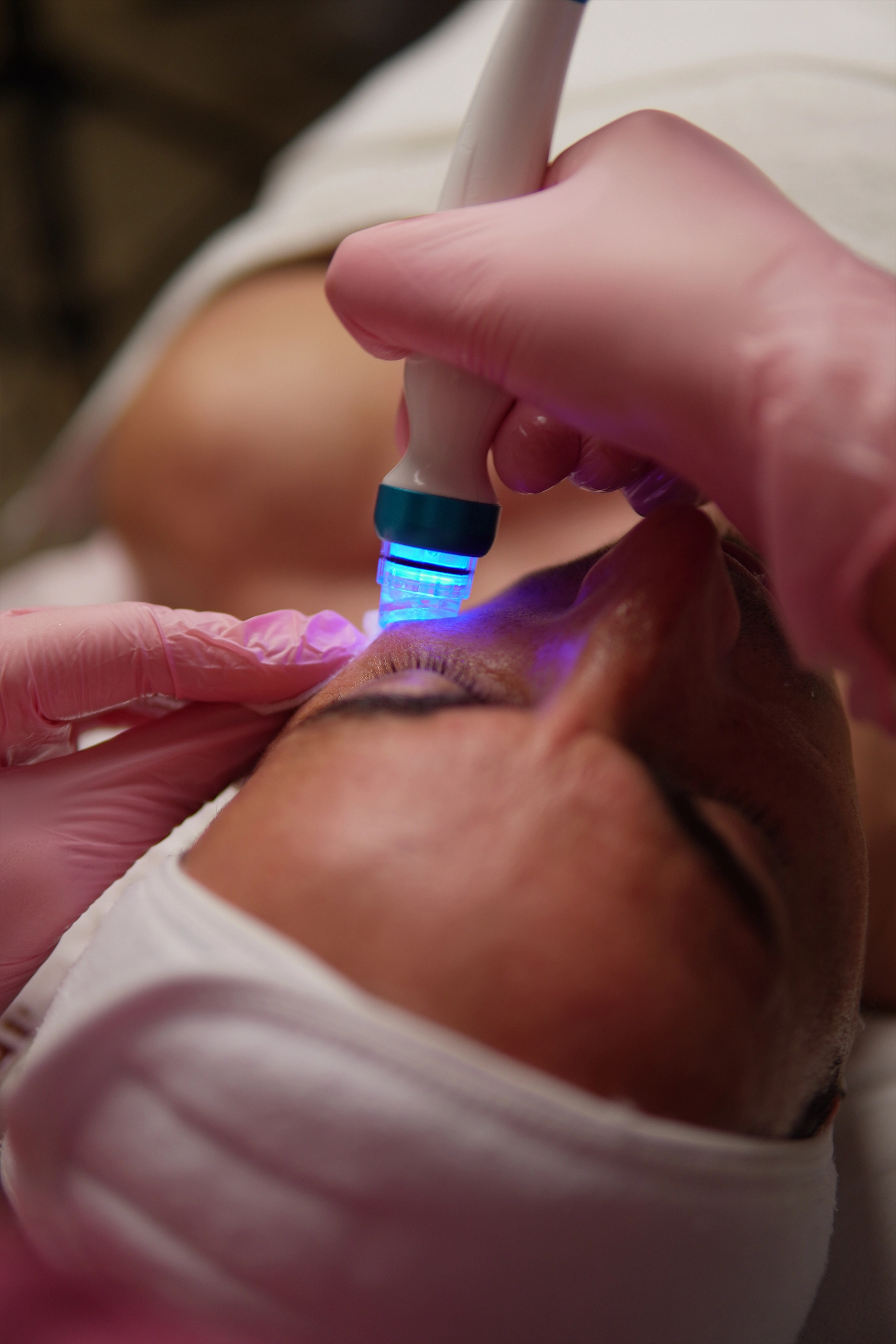 Higiene Skin Reset en Clínica Koa: higiene facial profesional con tecnología para limpiar y renovar la piel.