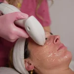 Radiofrecuencia Reaction facial 5 sesiones aplicada en el rostro durante un tratamiento en Clínica Koa