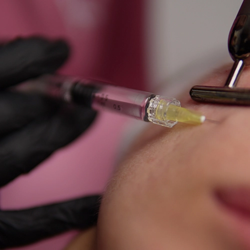 Rehidratación facial aplicada con microinyección durante un tratamiento en Clínica Koa