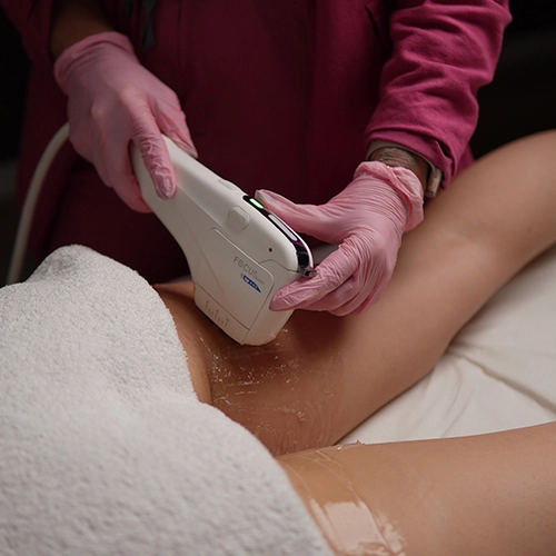 Tratamiento HIFU corporal no invasivo aplicado en abdomen para reafirmar y moldear en Valencia