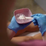 Brazos Hombre: preparación del tratamiento estético corporal en Clínica KOA