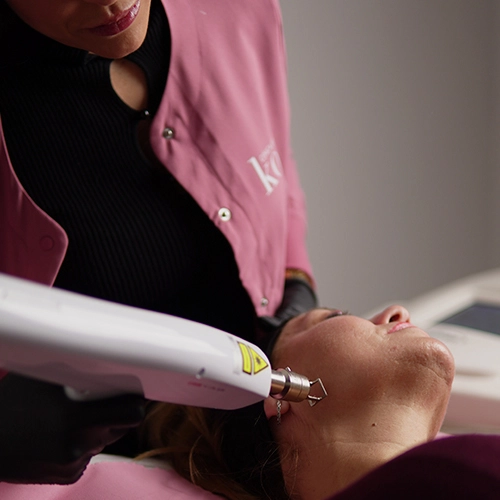 Láser Erbio YAG 2 Sesiones aplicado en el rostro durante un tratamiento facial en Clínica KOA