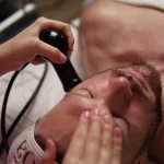 Tratamiento Mesoeclat con radiofrecuencia facial para rejuvenecimiento de la piel en Clínica Koa