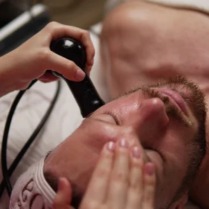 Mesoeclat con Radiofrecuencia
