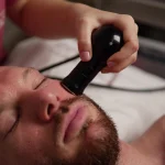 Radiofrecuencia Facial Deep 5 sesiones aplicada en el rostro de un hombre en Clínica KOA