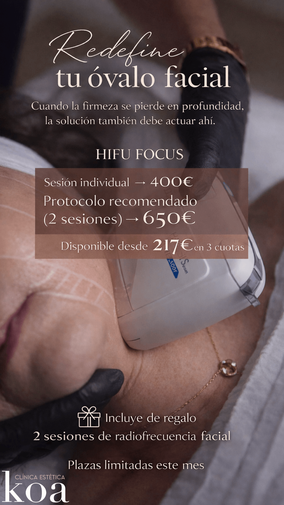 Especial HIFU by FOCUS, un tratamiento que actúa justo donde empieza la flacidez
